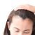 Αραίωση στα Μαλλιά; Μάθετε 2 Εύκολα Μυστικά για την Αντιμετώπιση του Προβληματος